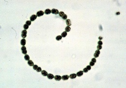 Obr. 2 Příklad mikroedafonu – sinice